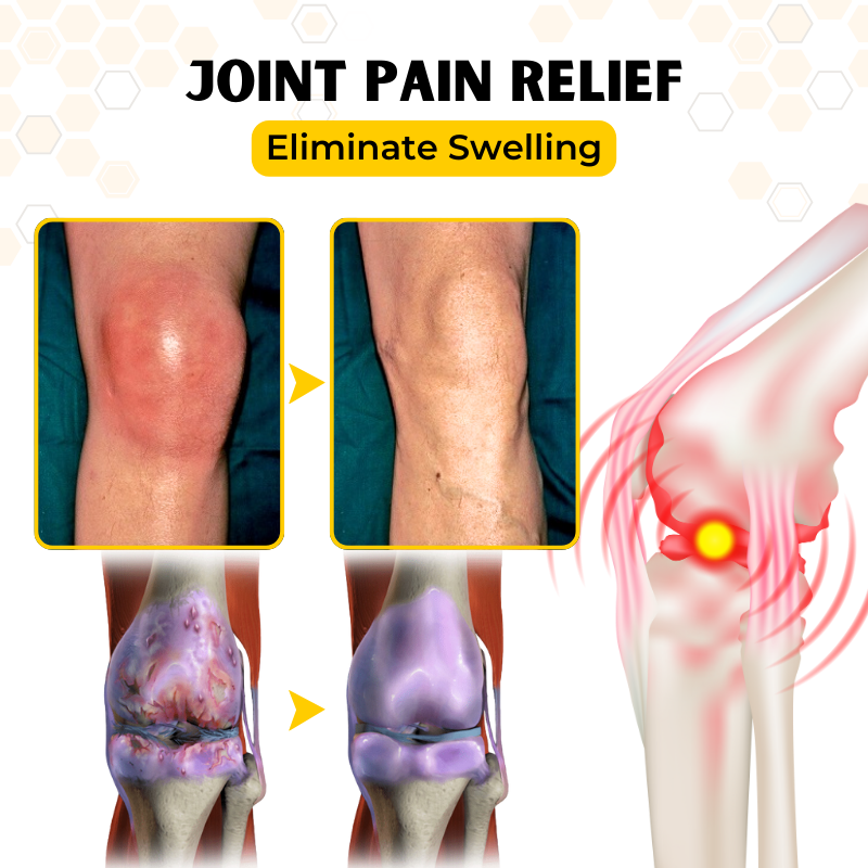 Biancat™ OrthoRestore Bee Venom Joint Relief Cream (New Formula)